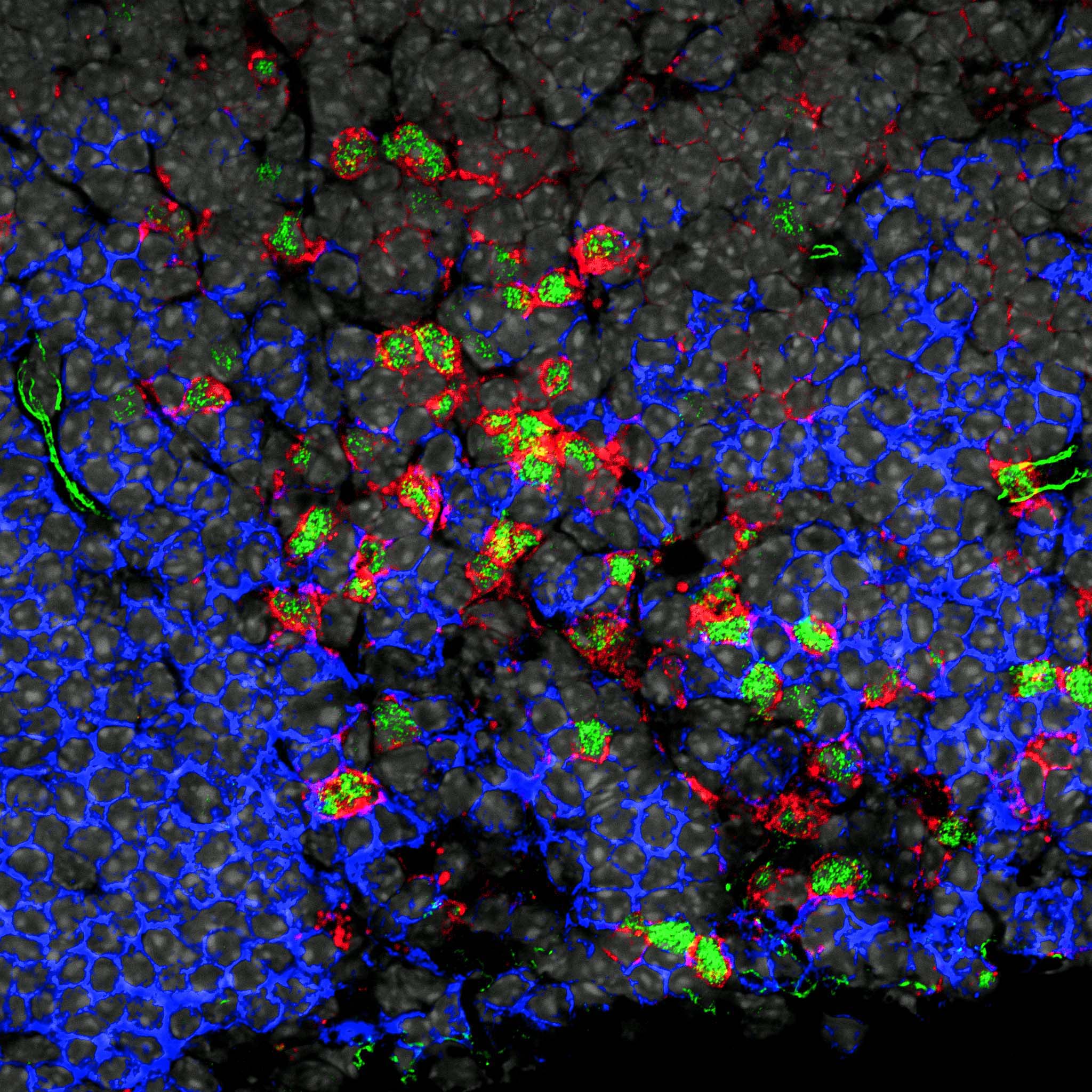 Innate lymphoid cells in tissue